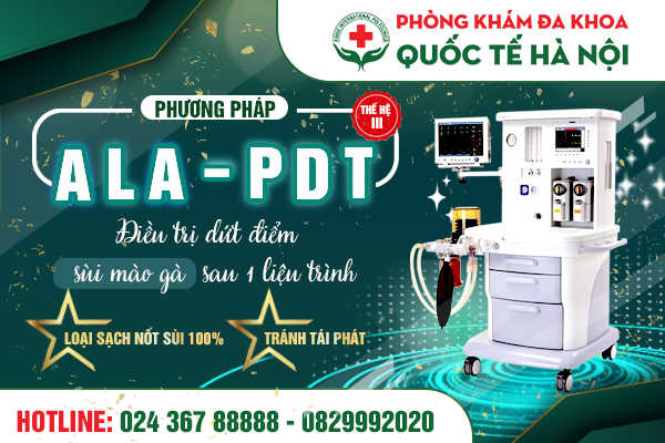 pp ALA - PDT