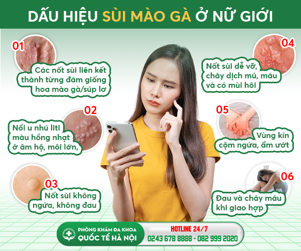 sùi mào gà ở nữ