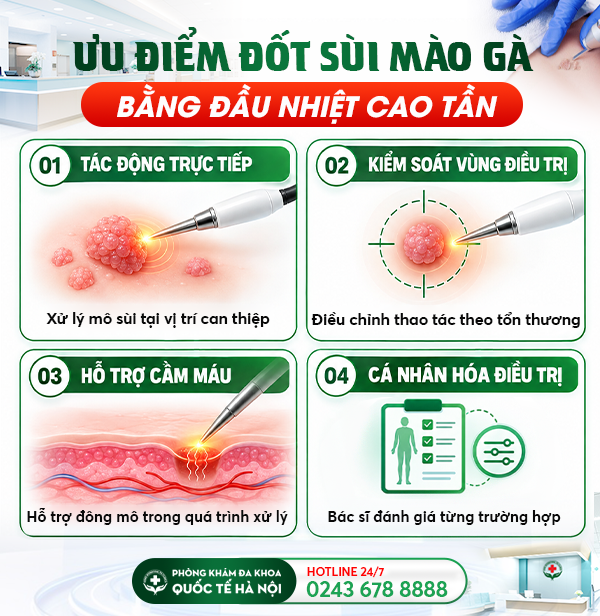 điều trị sùi mào gà