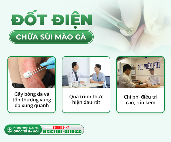 đốt điện sùi mào gà