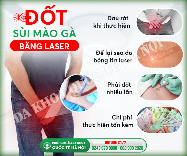 đốt sùi mào gà bằng nito laser