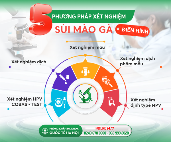 xét nghiệm sùi mào gà